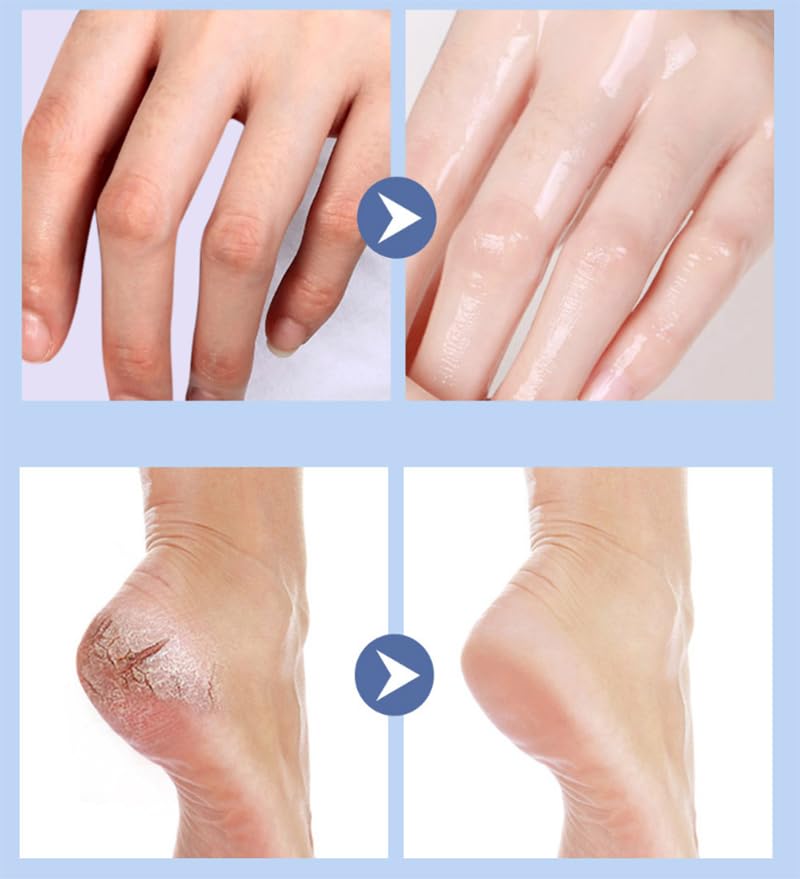 Eoursha Foot Healing Cream 2-in-1